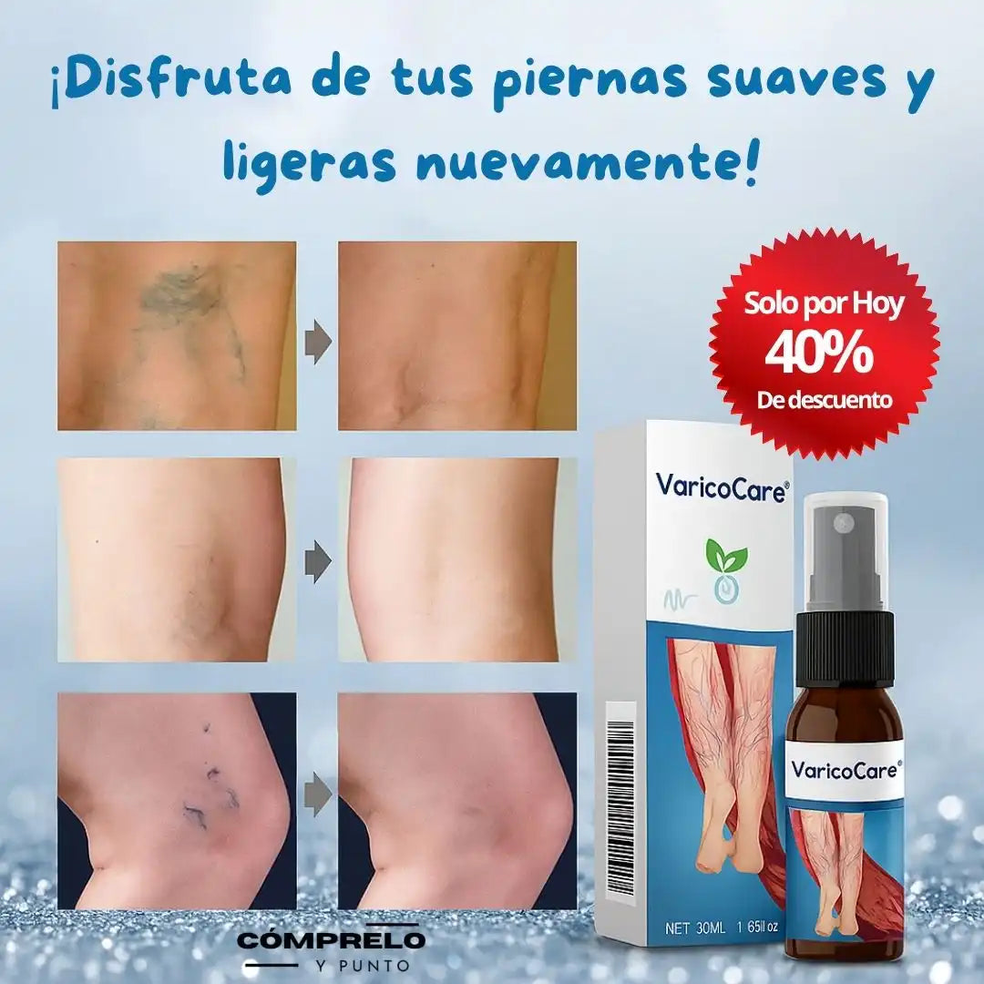 VaricoCare™ - Spray Reductor de Venas Varicosas y Alivio de Piernas Cansadas